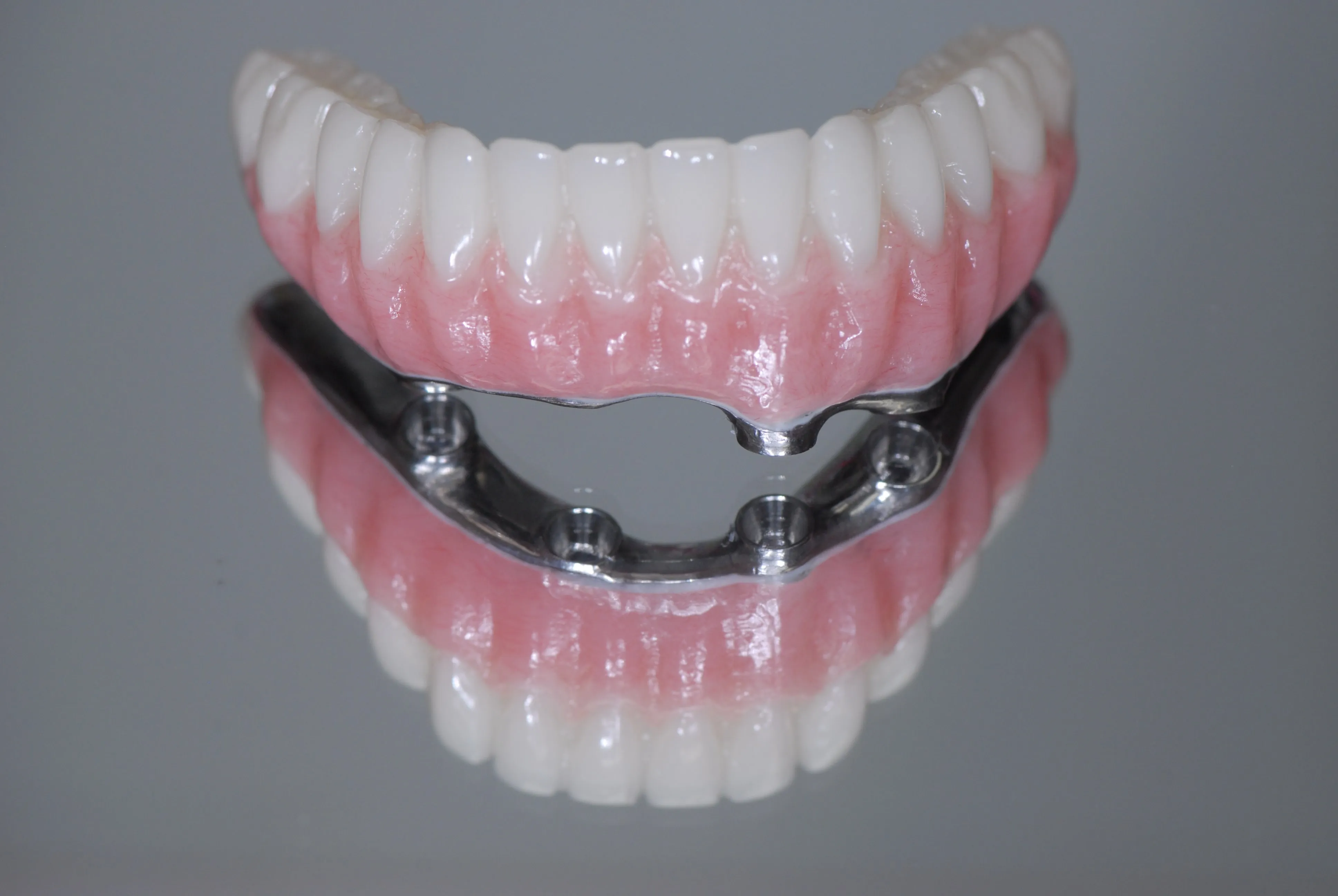 All-on-X full arch dental implants