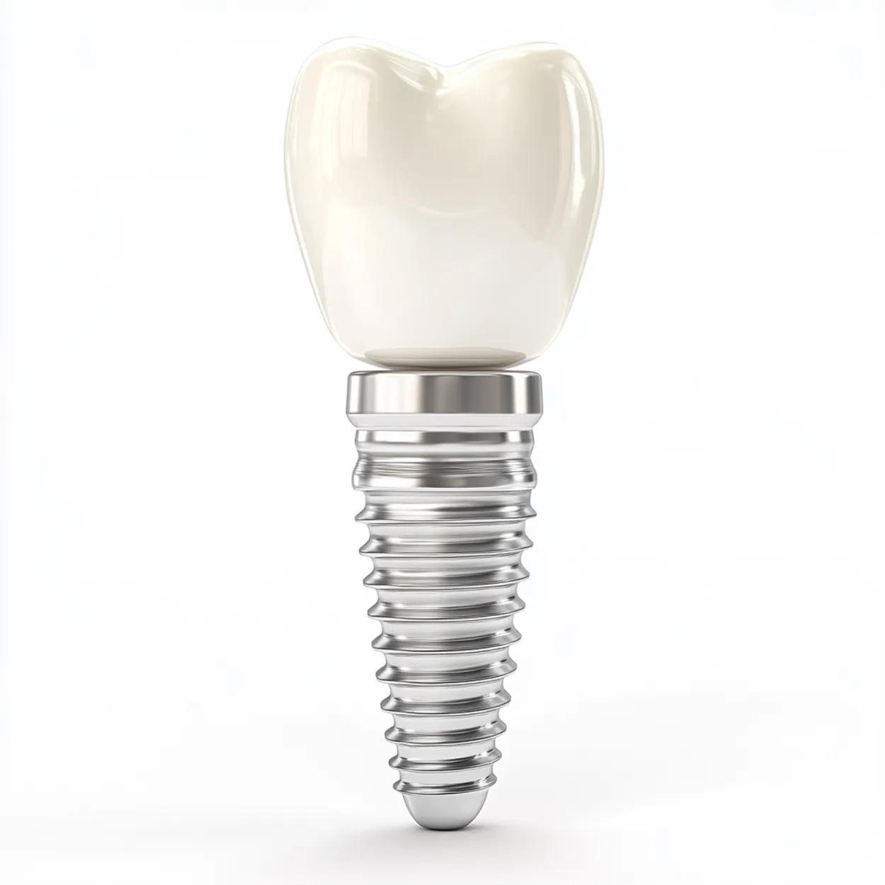 Cover for How Much Do Dental Implants Cost in Georgia? (2026 Guide)